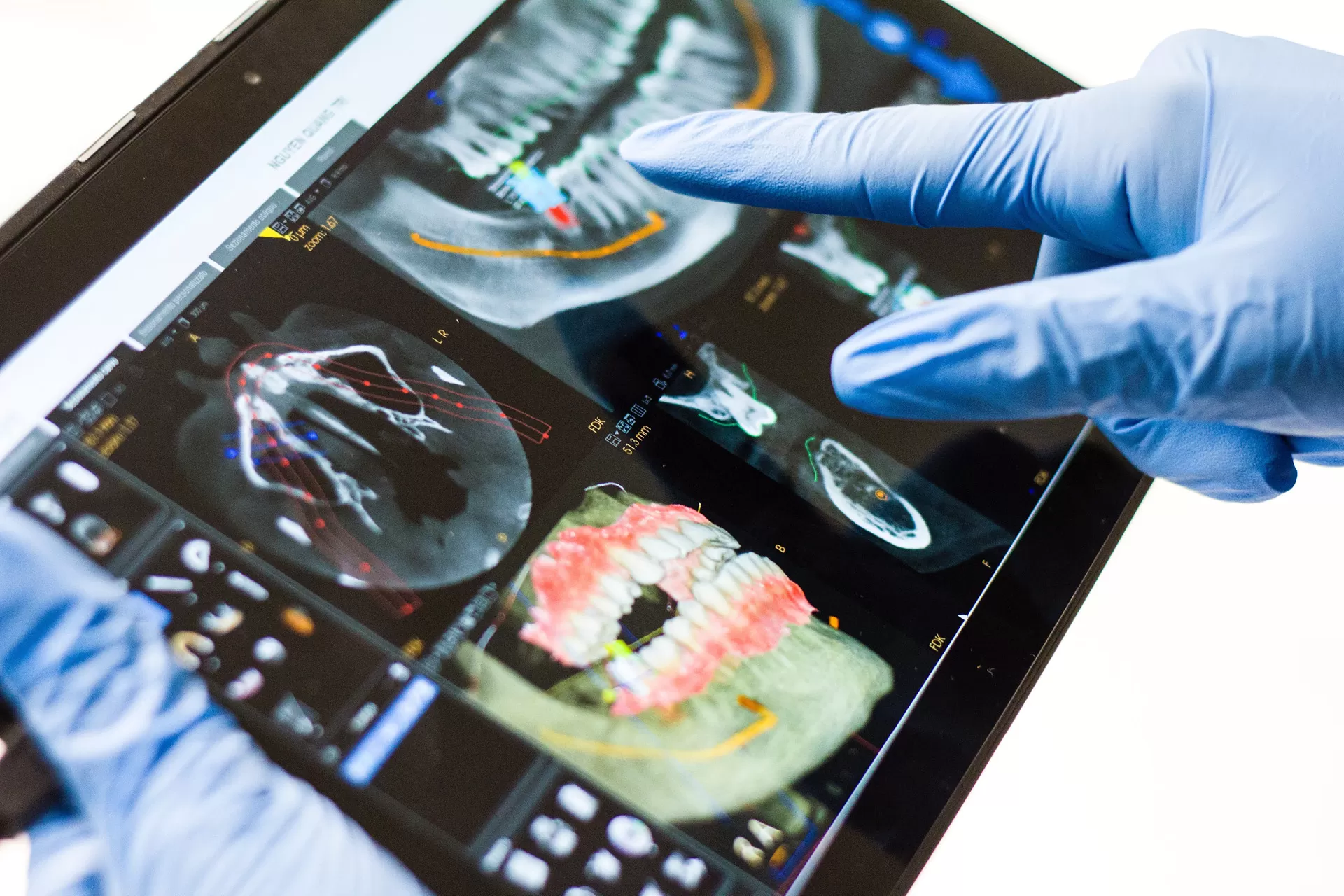 Smart View Pad für den digitalen Zahnarzt – die neue Art, mit dem Patienten zu kommunizieren.